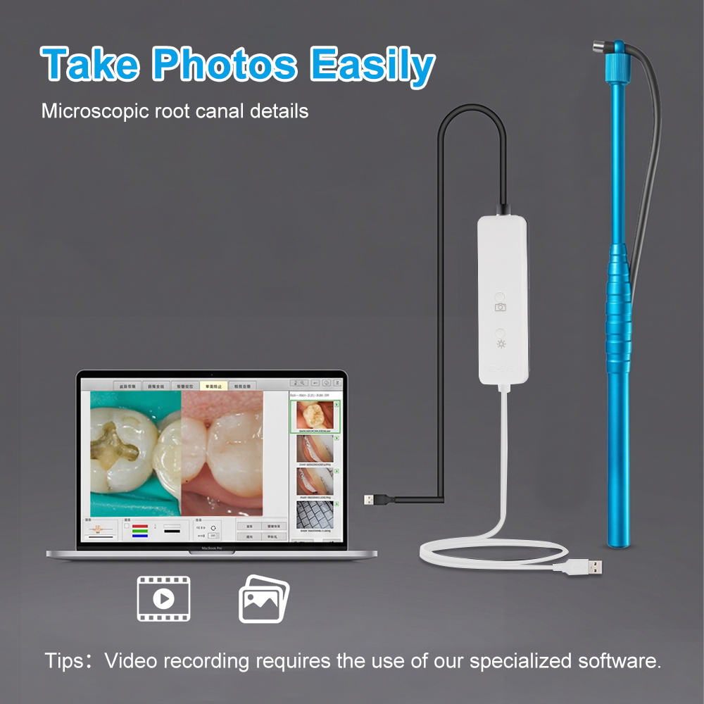 5MP Micro Intraoral Camera Den - Mini Pc Windows 리뷰 및 가격